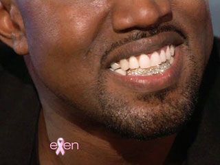 kanye teeth